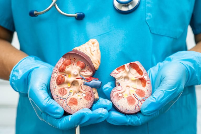 Foods That Help Prevent Kidney Stones – Recommended by the Best Urology Doctors in Kolkata