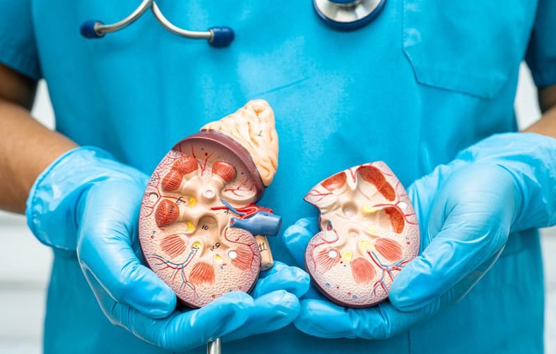 Foods That Help Prevent Kidney Stones – Recommended by the Best Urology Doctors in Kolkata